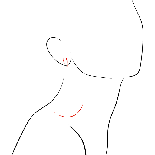 Earring on the Ear — step 2