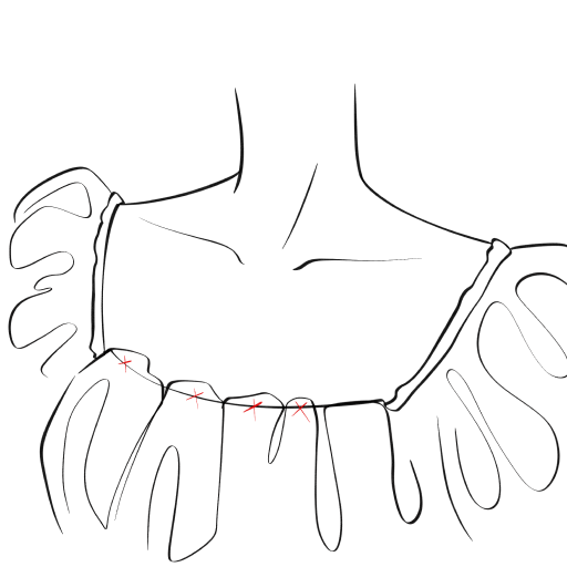 Necklace on the Neck — step 7